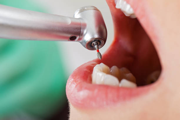 Best Emergency Broken Tooth Repair in Dorr, MI